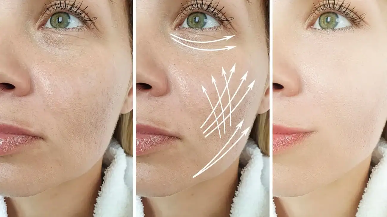 Can One Treatment Really Tackle More Than One Skin Concern Wootton Bassett?