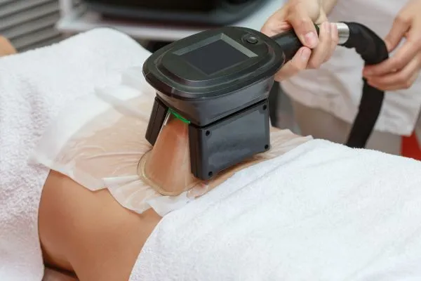 Image of person having fat freezing treatment to help weight gain Wootton Bassett