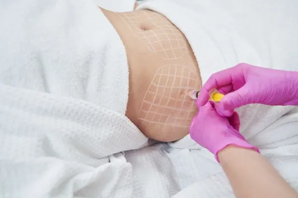 image of fat dissolving injections on love handles to help combat weight gain Wootton Bassett
