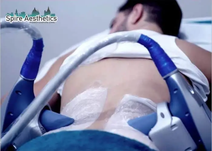 Man having fat freezing treatment done on love handles before a competitions Wootton Bassett to create a sculpted look.