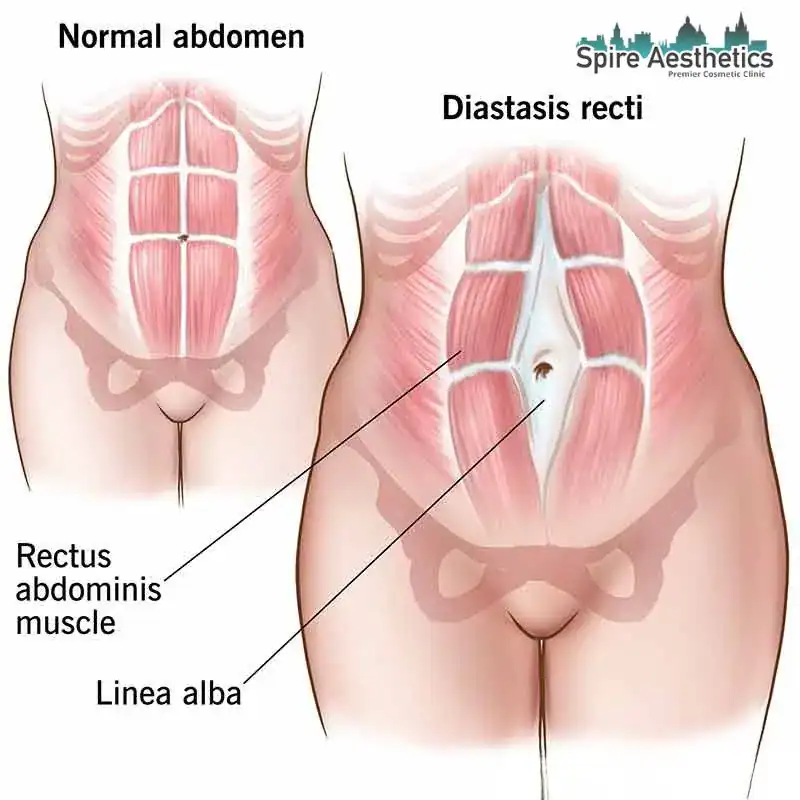 When Will My Belly Feel Normal Again Wootton Bassett?