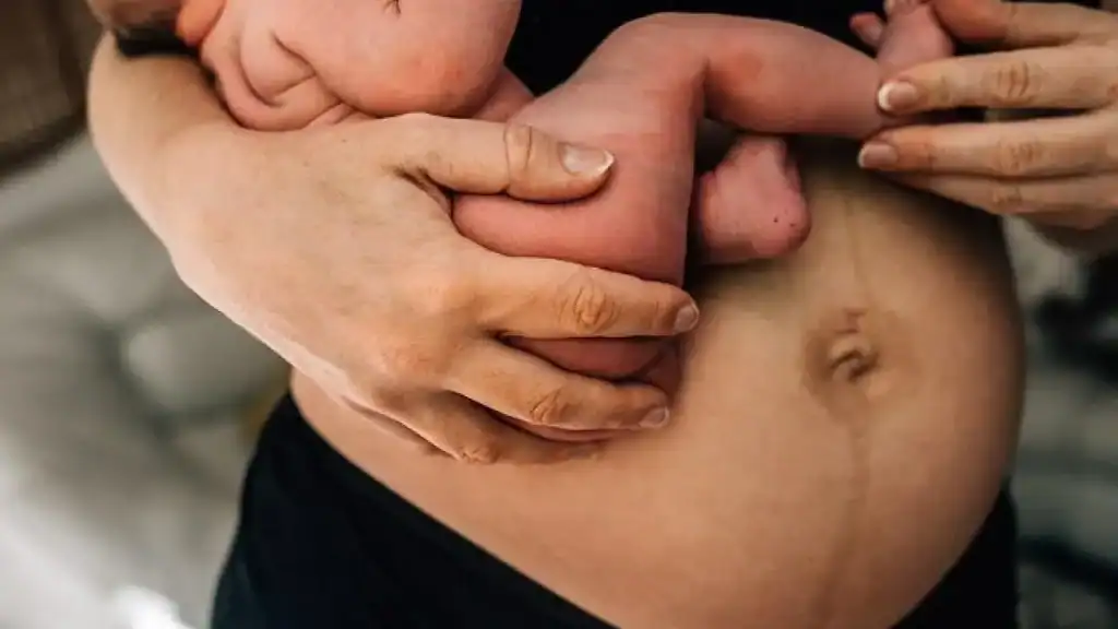 Why Is My Stomach Still Big After Pregnancy Wootton Bassett?